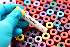 Legionella prevention